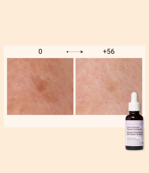 Sérum Anti-Taches Aroma Zone Éclat Instantané - 30ml, 100% Naturel, à La Hordatine Et Niacinamide, Neuf