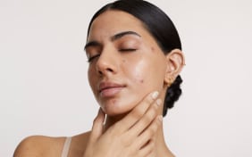 Che cos'è l'effetto rebound dell'acne?