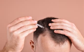 Perte de cheveux homme : que faire ?