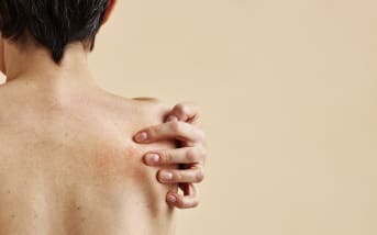 Dermatite séborrhéique : causes et symptômes