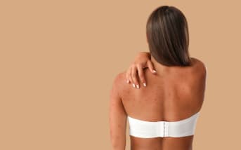 Bouton de varicelle : quelles solutions naturelles apaisantes ?