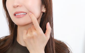 Perlèche : Quelles solutions naturelles ? 