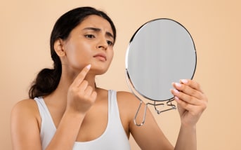 Mycose visage : symptômes, précautions et conseils essentiels