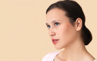 Comment réduire les excès de sébum ?
