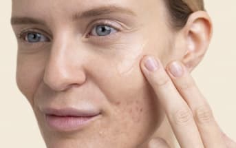 Aloe Vera et acné : quels bienfaits ?