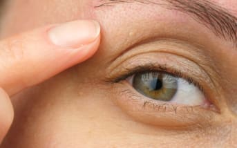 Grains de milium : prévention et solutions naturelles