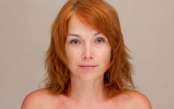 Come trattare le macchie di pigmentazione in modo naturale?
