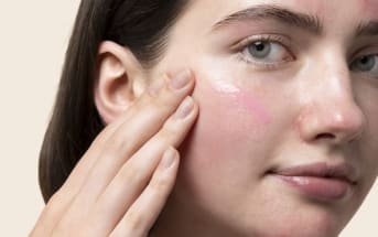 Rossori e irritazioni: i nostri trattamenti più apprezzati, approvati dai nostri esperti