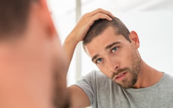 Calvitie : peut-on vraiment l’arrêter ? Lou Doumas, naturopathe, nous donne sa réponse