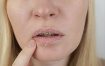Lèvres sèches ? Ce geste inconscient pourrait bien être le vrai responsable