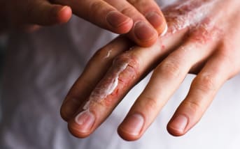 Hydrater ses mains en hiver : l’erreur que tout le monde fait (et qui les abîme encore plus)