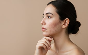 Excès de sébum au visage : quelles sont les causes ?