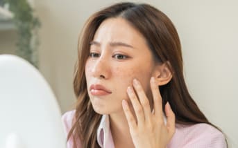 Vous avez une peau à imperfections ? Voici les erreurs d’hydratation que vous faites (sûrement) sans le savoir