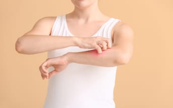 Plaques d'eczéma : quelles solutions naturelles ?