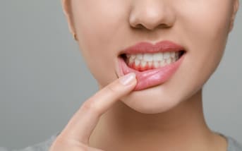 Redécouvrir un rituel ancestral : l’oil pulling pour votre santé bucco-dentaire