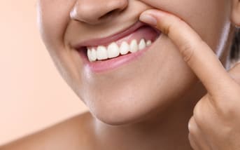 Gencives qui gonflent : causes et astuces naturelles