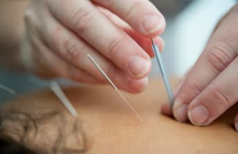 L'acupuncture : Une méthode millénaire pour soulager la douleur et améliorer la santé