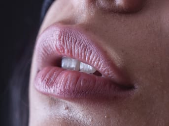 Lèvres gercées : comment les soulager naturellement cet hiver ?