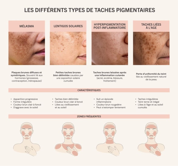 Les différents types de taches