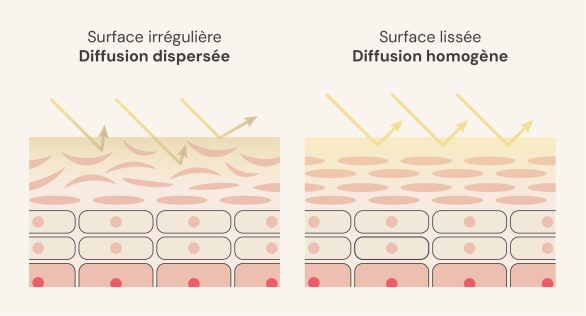 peau exfoliée
