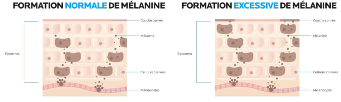 mélanine.png