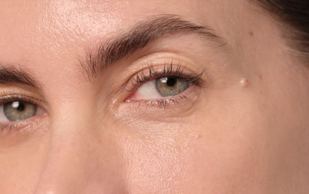 Lutter contre l'eczéma des yeux et des paupières