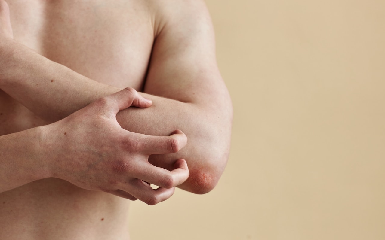 Zoom sur le Psoriasis des plis ou "psoriasis inversé"