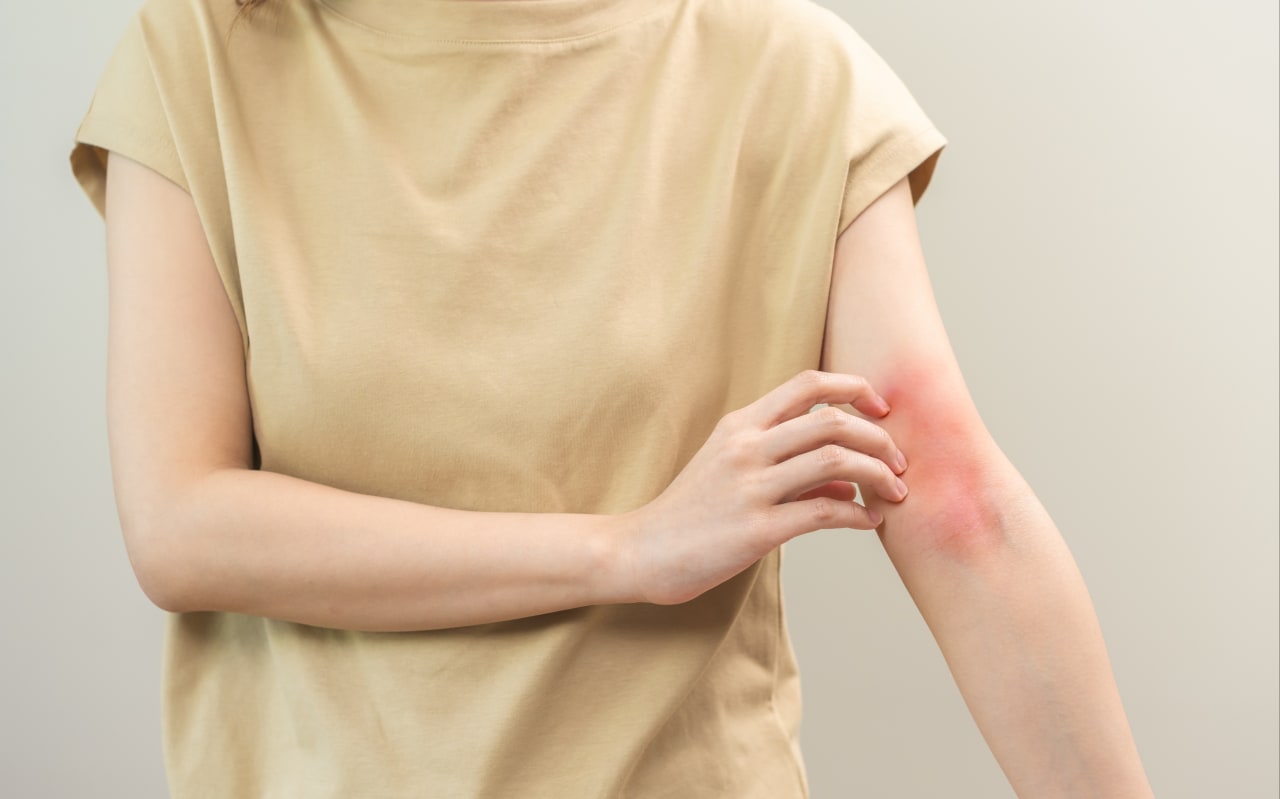 Allergie et plaque rouge : Causes et symptômes