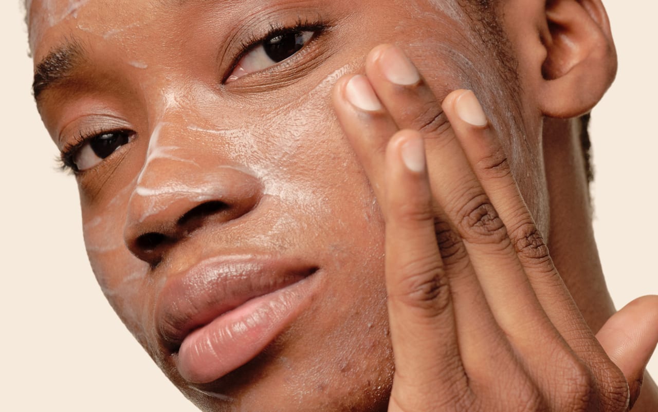 Come prevenire l'acne rebound: i gesti che fanno la differenza