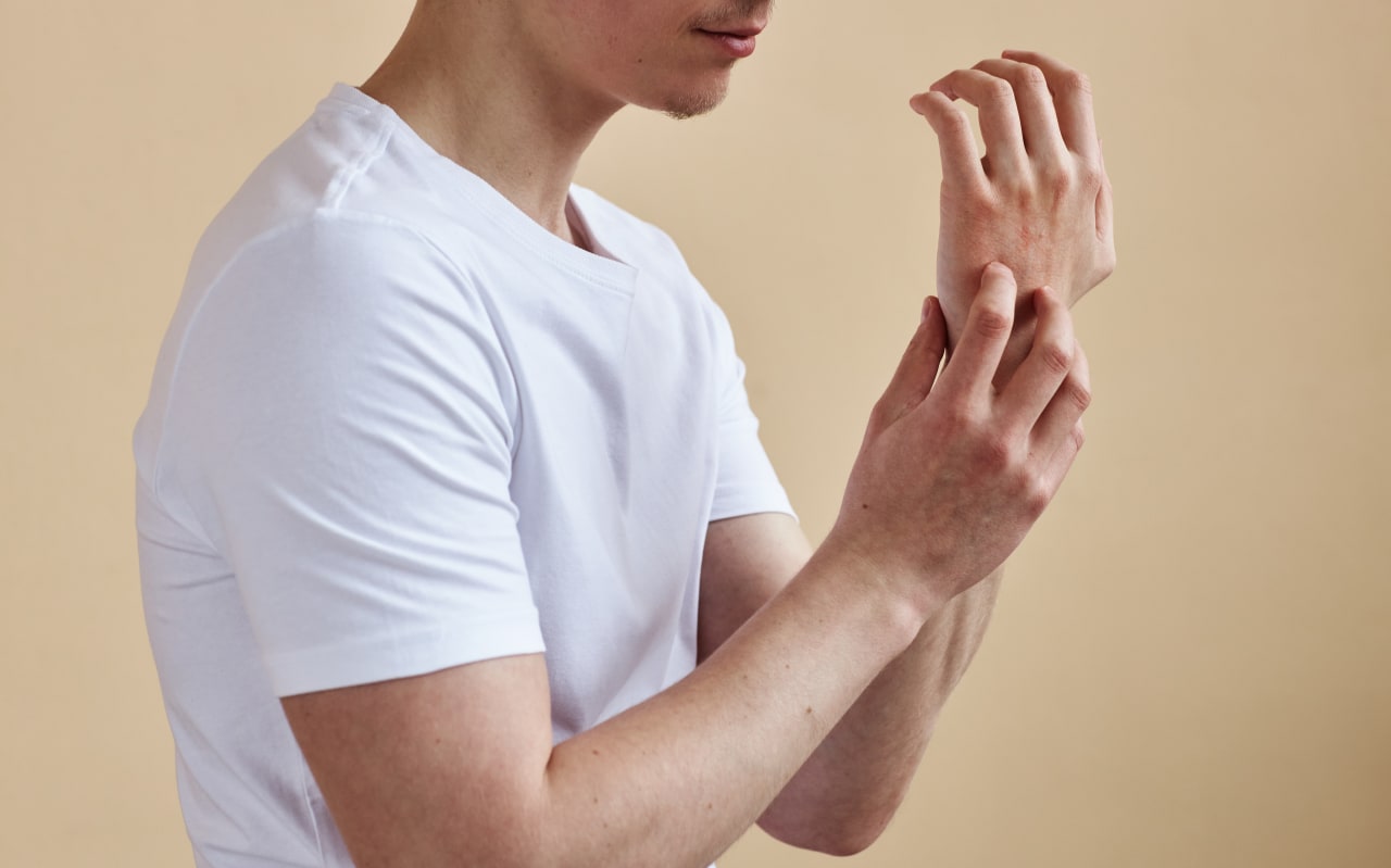 Urticaire et soleil : causes et symptômes