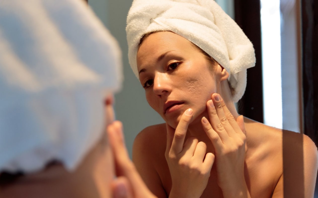 Dermabrasion : tout savoir sur cette solution dermatologique
