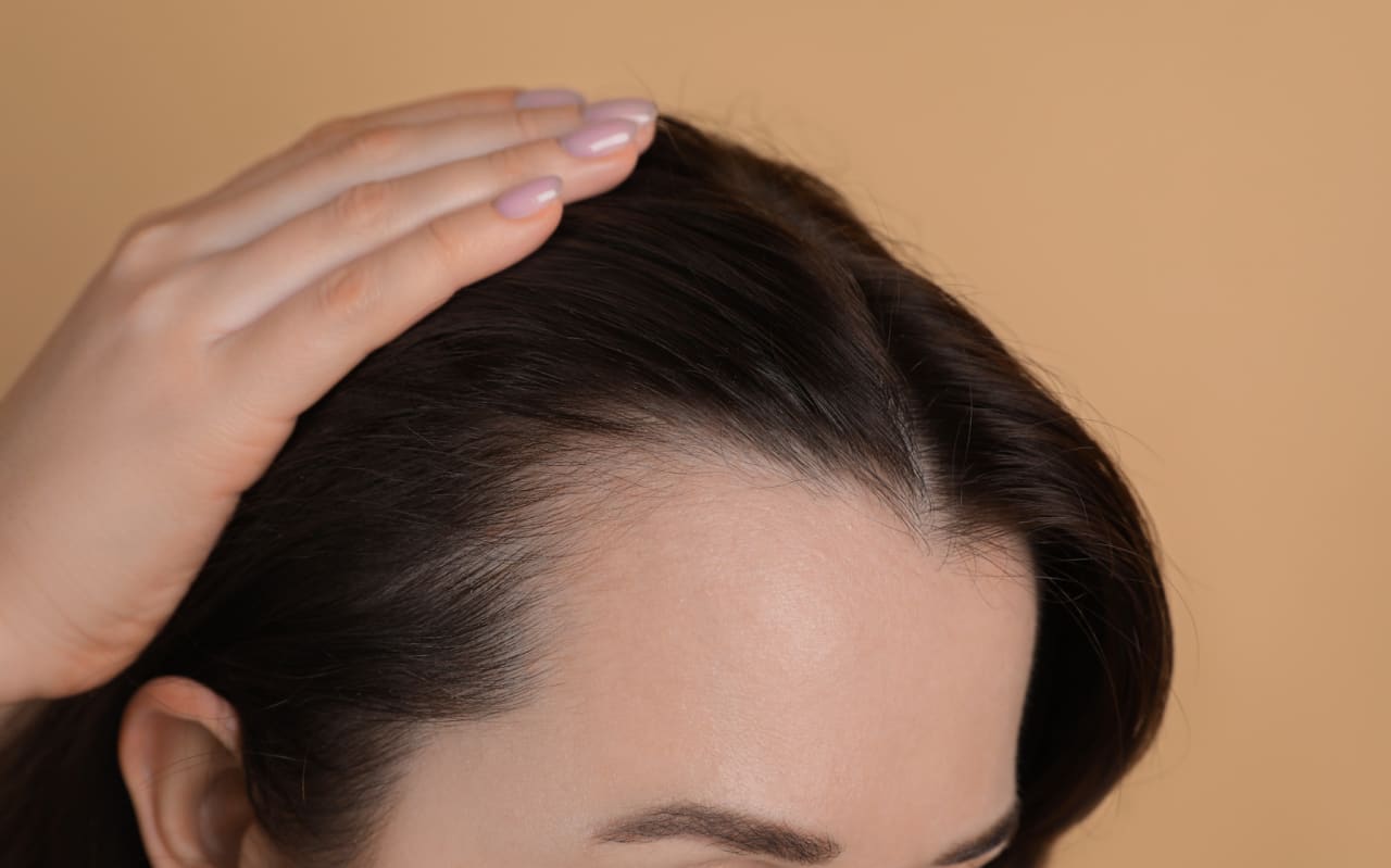 Diradamento capelli: cause, benefici e soluzioni naturali