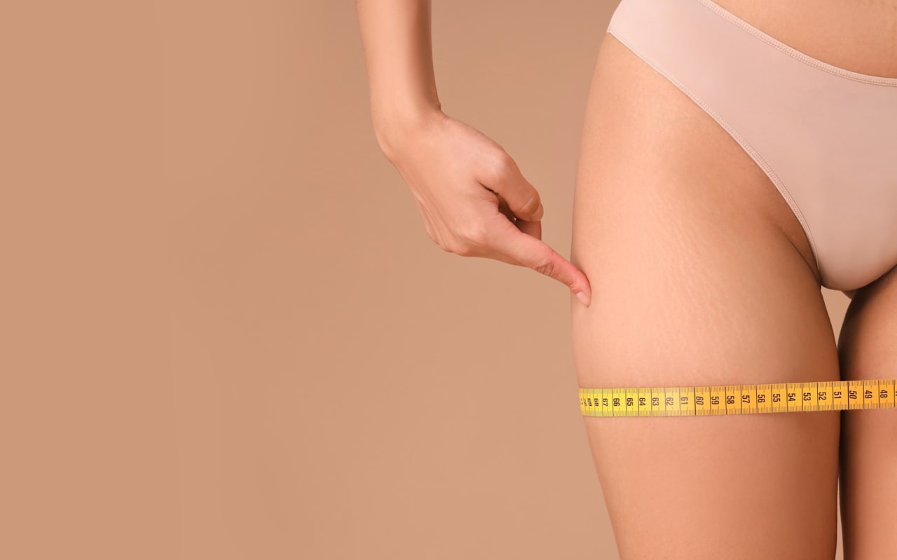 Comment enlever la cellulite naturellement : découvrez nos meilleures astuces