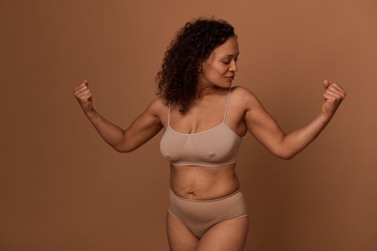 Vergeture au bras : causes et solutions naturelles