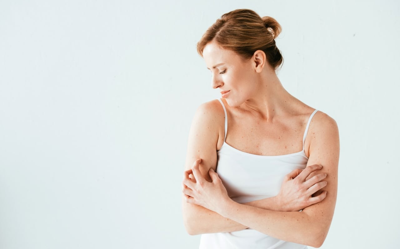 Crise d'urticaire : nos solutions naturelles