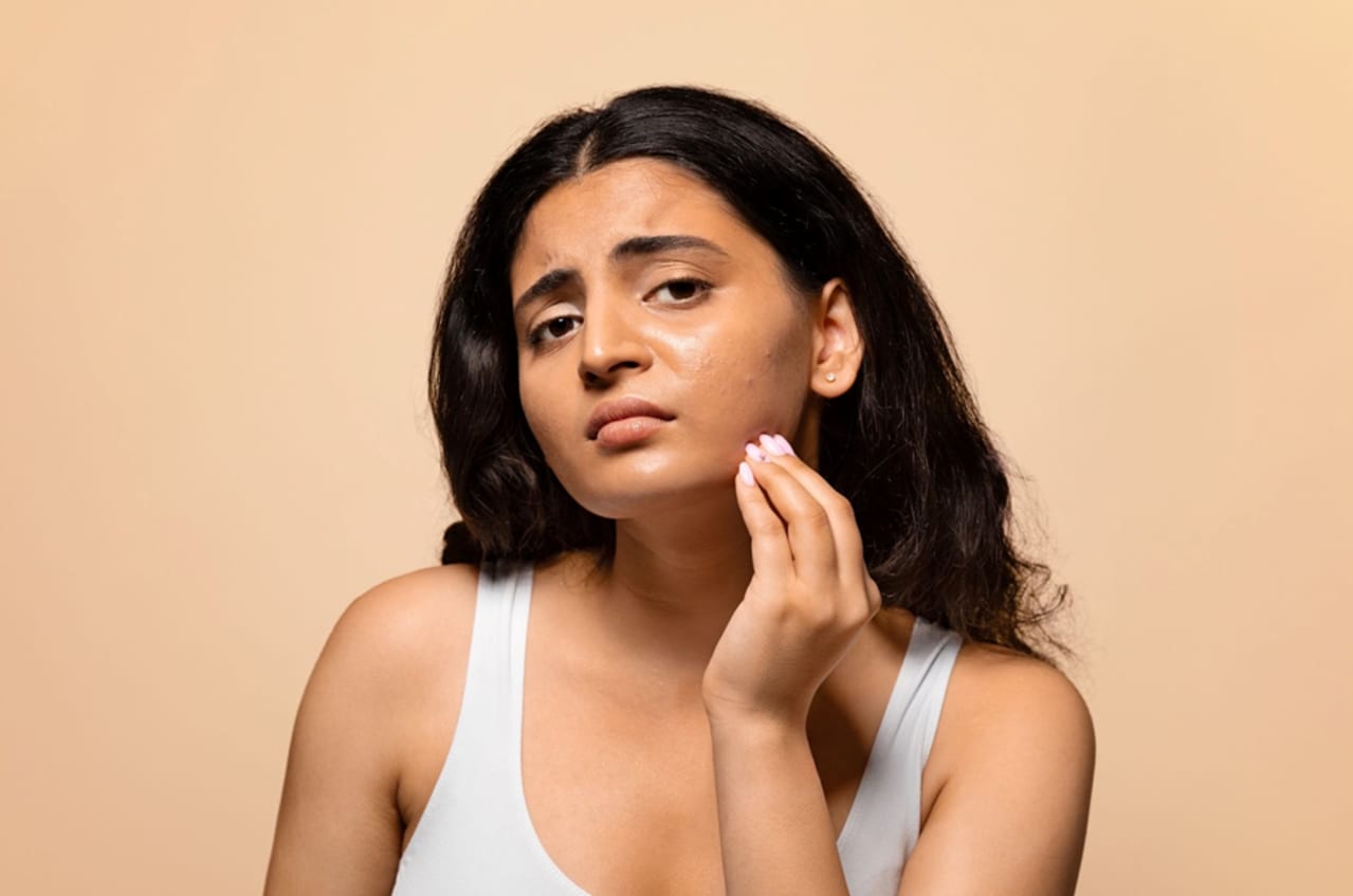 Dermatite actinique : définition, origines et solutions pratiques