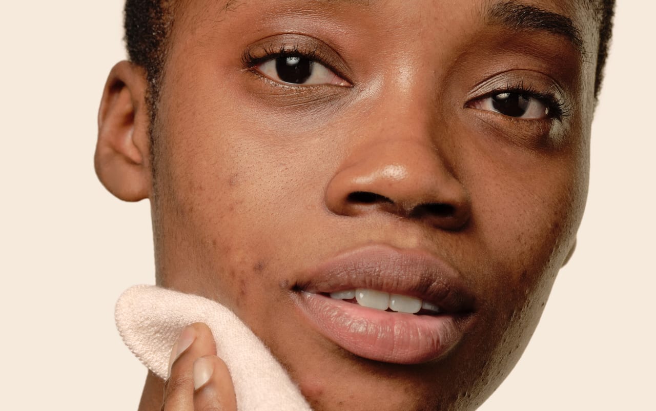 Peaux à problèmes : les erreurs à éviter selon nos dermatologues