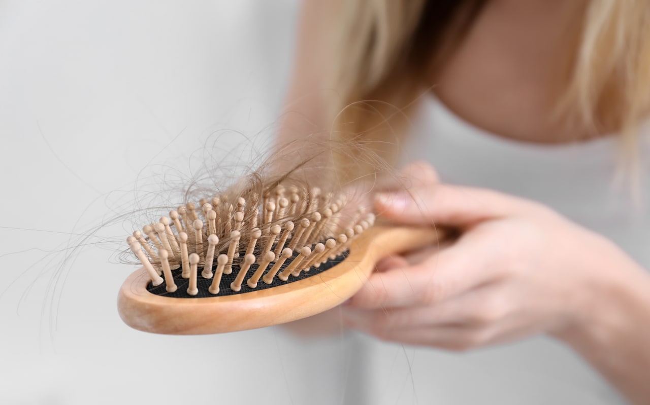 Alopécie chez la femme : causes et symptômes