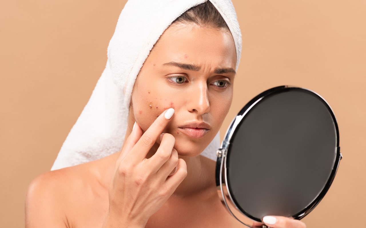 Points blancs sur le visage : prévention et solutions naturelles