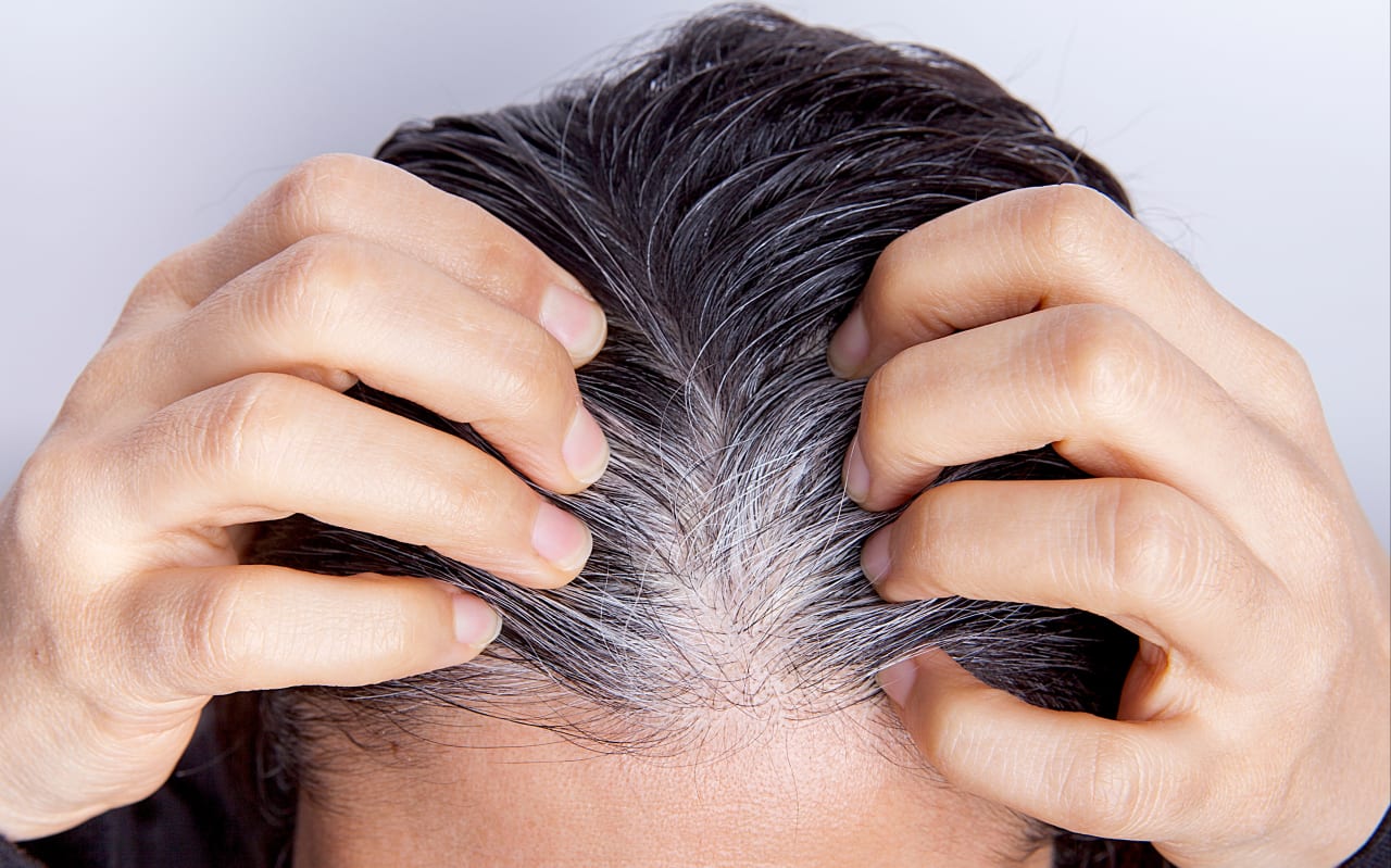 Les cheveux blancs dès 20 ans : est-ce vraiment possible ?