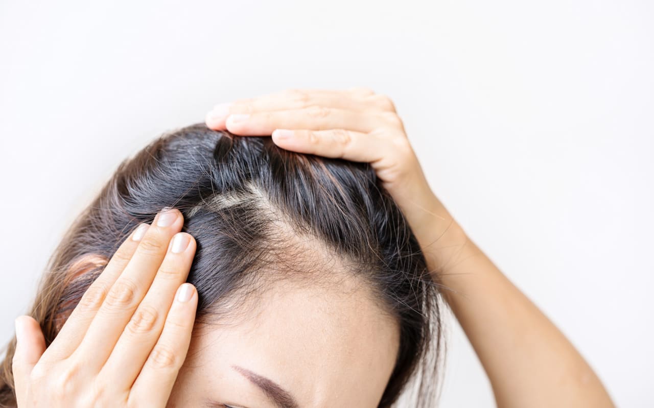 Cheveux fragiles au printemps : la routine sérum anti-chute
