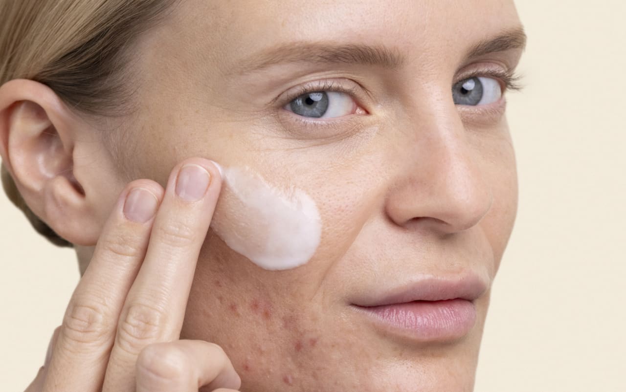 Imperfections : nos soins les mieux notés validés par nos experts