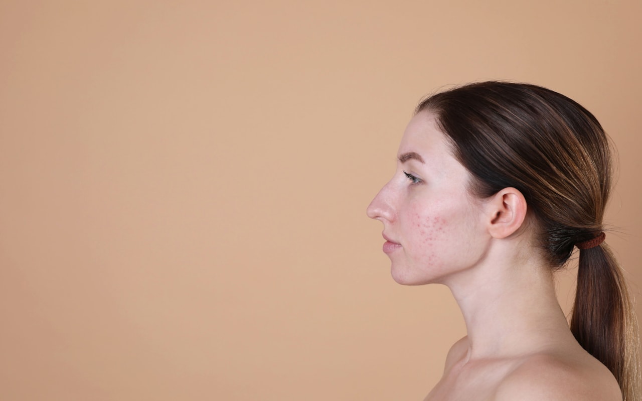 Le Zinc et imperfections - Quel lien ?
