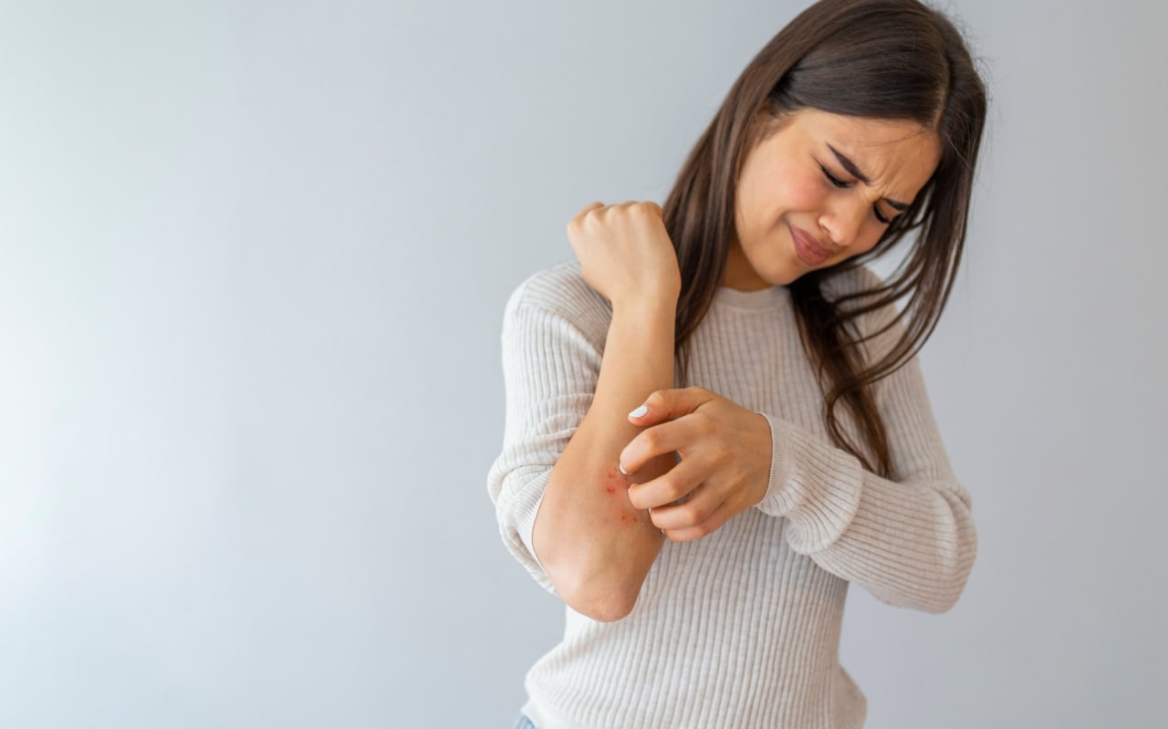 Dermatite da contatto: cause, sintomi, soluzioni naturali... tutto quello che c'è da sapere!