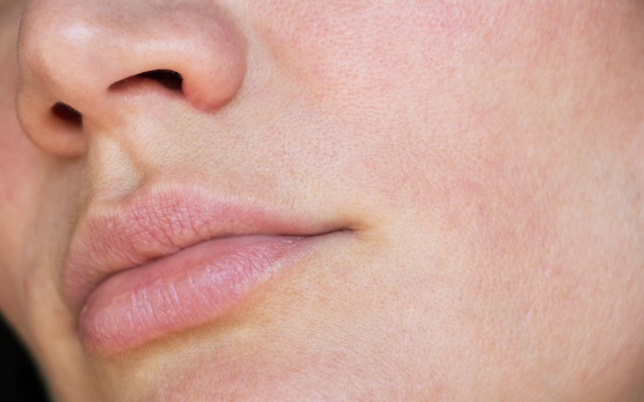 Mito o realtà: bisogna evitare tutti i principi attivi potenti sulla pelle sensibile?