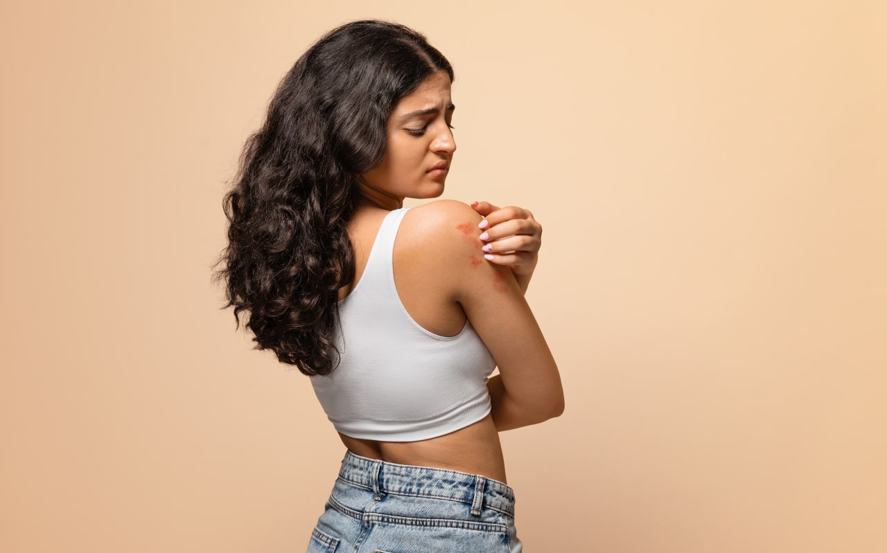 Scorbut : causes et symptômes de cette carence oubliée