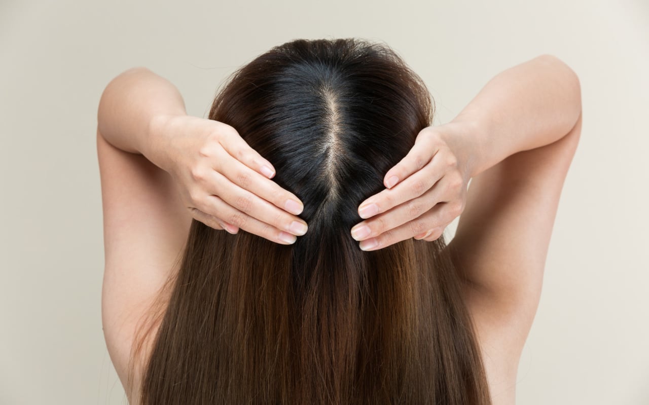 How can I fight scalp psoriasis naturally?