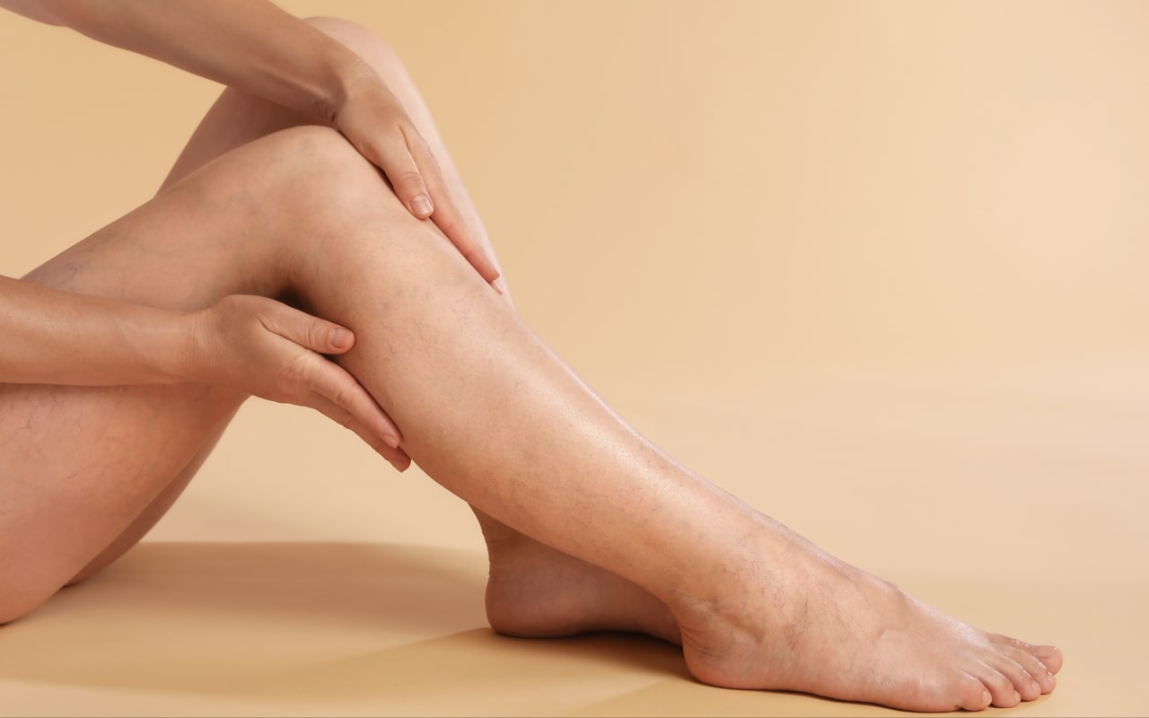 Jambes lourdes et fatigue : Quel lien ?
