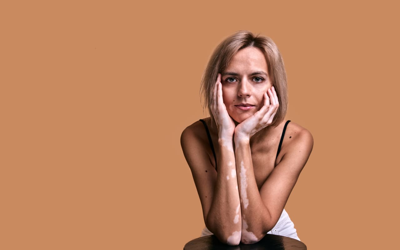 Pityriasis alba : causes et symptômes ?