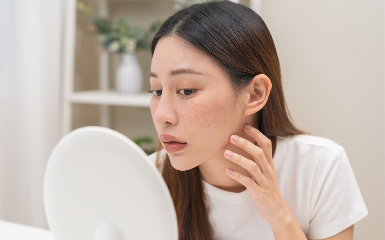 Pelle asfittica: i nostri rimedi e soluzioni naturali